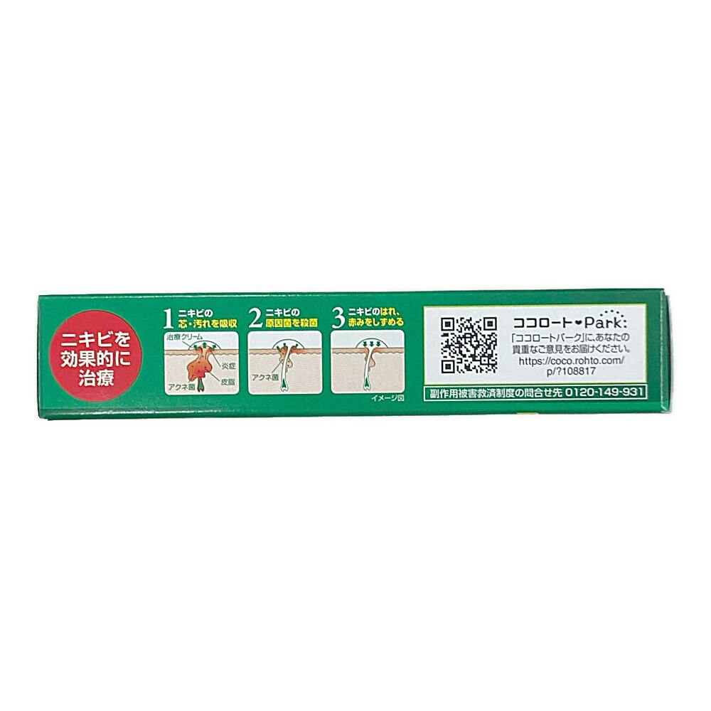 店舗限定】第2類医薬品 ロート製薬 メンソレータム アクネス