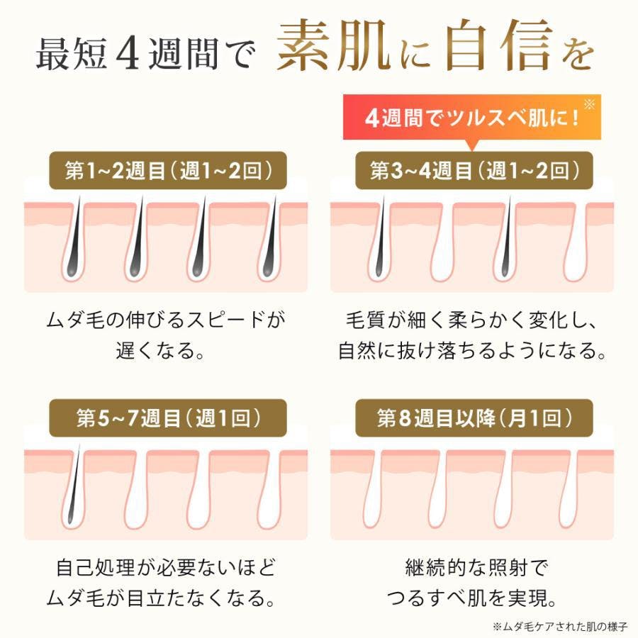 IPL 光美容器 冷却機能 99万回照射 EPIFLASH エピフラッシュ