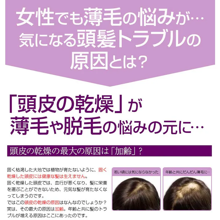 【薬用育毛剤 夢美髪(ゆめみはつ) 3個セット】 ちあふる 髪を支える土台の頭皮をケア!育毛・薄毛・脱毛予防・発毛促進 3つの有効成分と保湿成分を配合 潤いを与えて髪が育ちやすい環境へ 抜け毛 かゆみ 日本製 医薬部外品 JAN:4560258562027