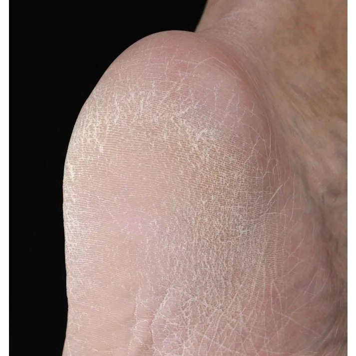 セーブ・インダストリー かかとヤスリ かかと削り かかとケア 角質ケア SV-7640【別送品】