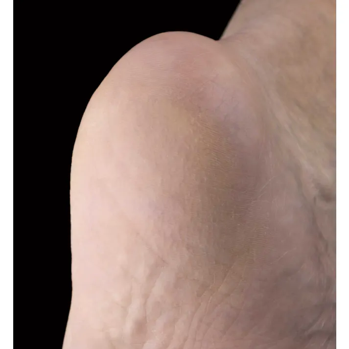 セーブ・インダストリー かかとヤスリ かかと削り かかとケア 角質ケア SV-7640【別送品】